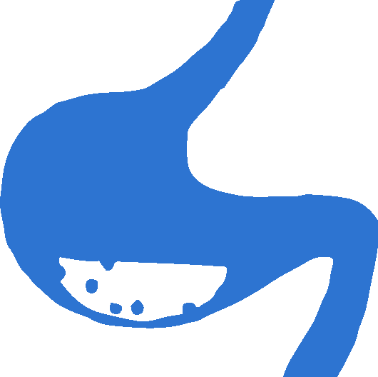 Inflammatory Bowel Disease