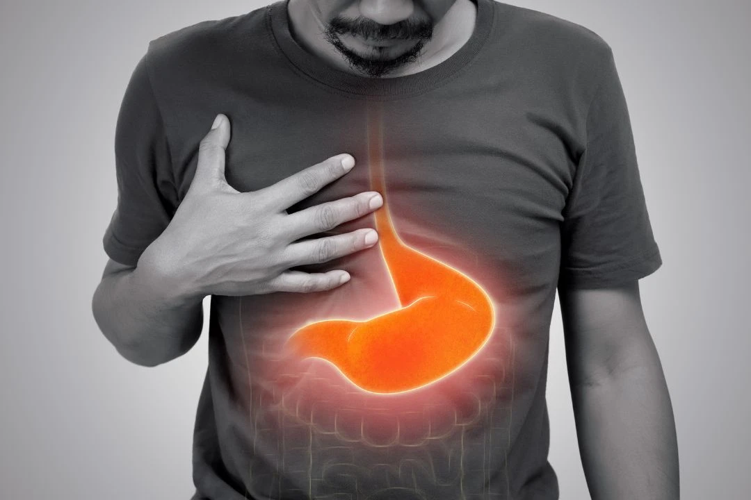 A man clutching his chest with a highlighted graphic of a stomach, suggesting he is experiencing heartburn or gastrointestinal discomfort.