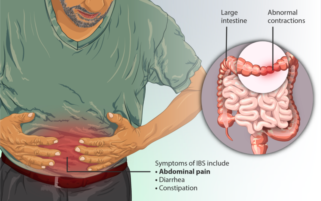 Recognizing IBS Symptoms – A Critical Step in Management
