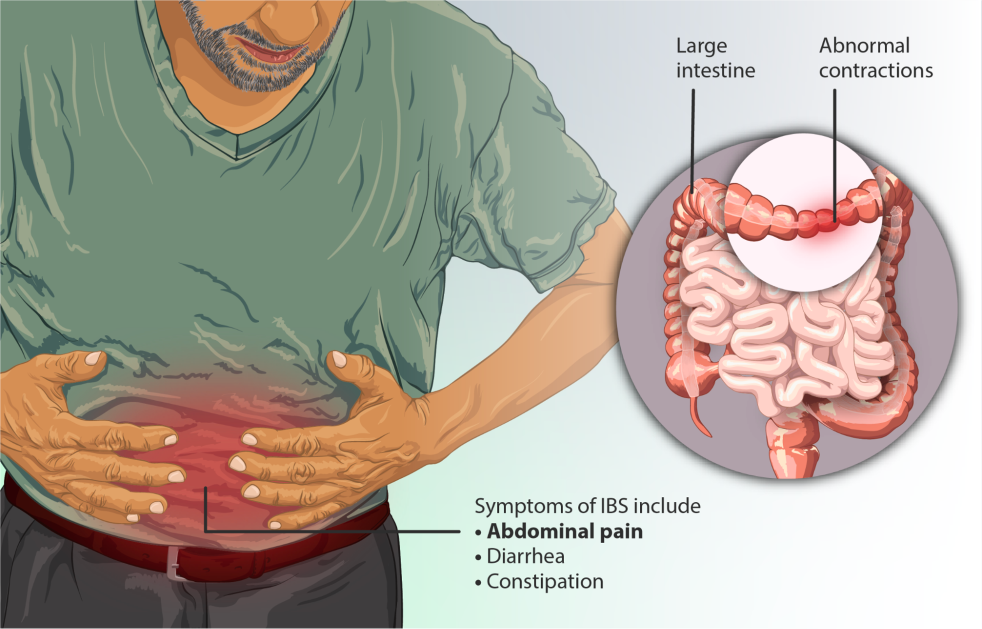 Recognizing IBS Symptoms - A Critical Step in Management